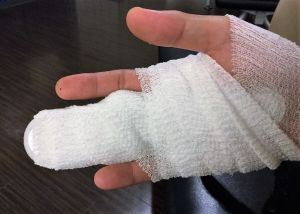海で転倒し、中指を骨折した男性